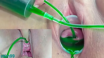 Japanese Lesbian Mayata'S Extreme Gynecological Procedures And Bdsm Play